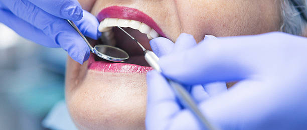 Best Emergency Dentist for Knocked-Out Tooth in Ozark, MO